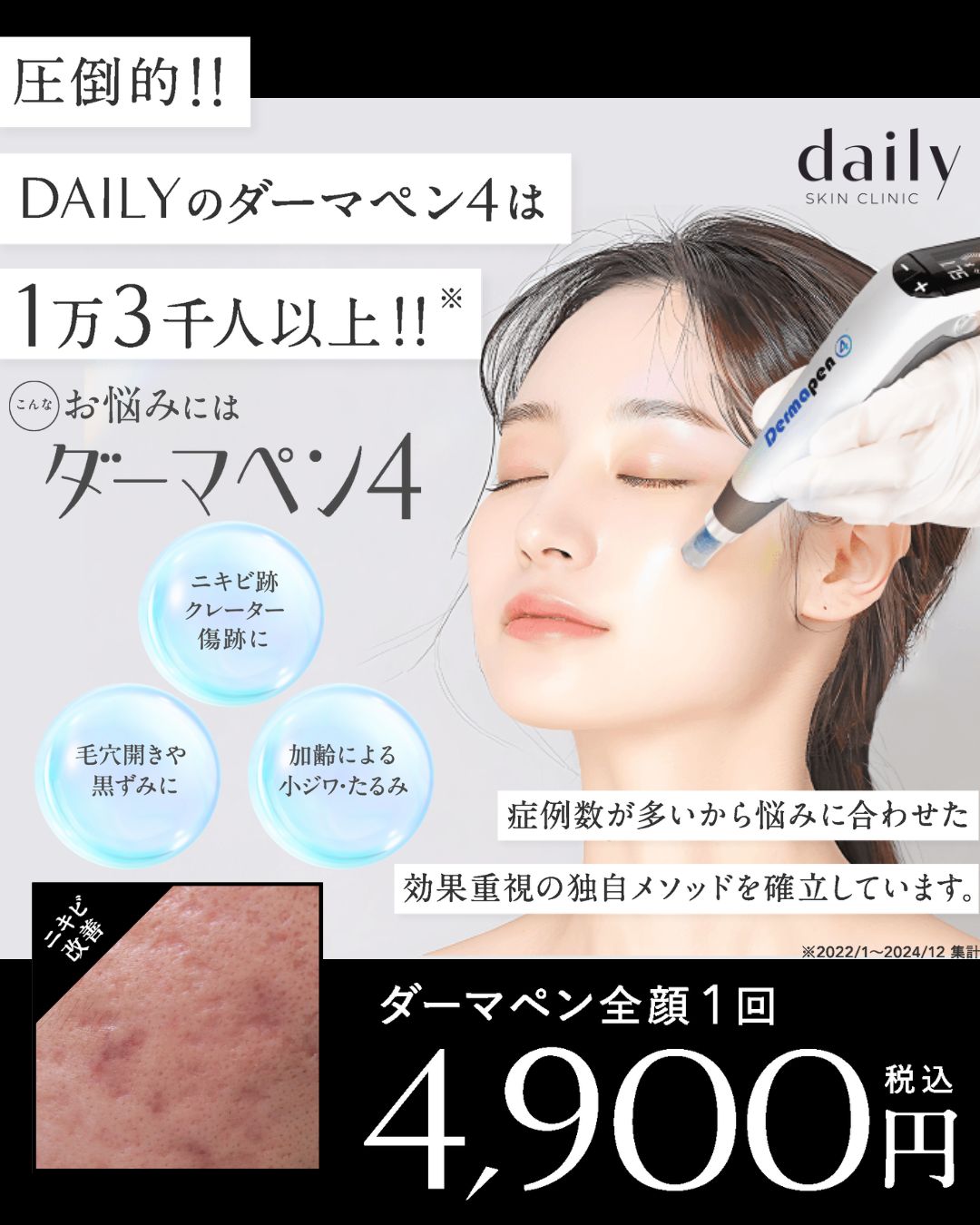 総施術数1万人以上！ 一人ひとりの肌に合わせて施術プランをご用意