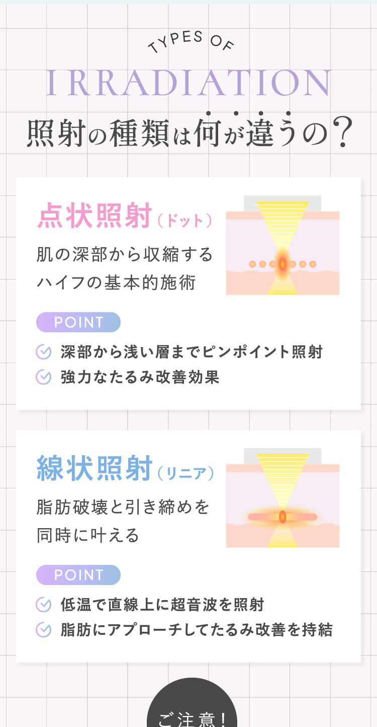 照射の種類は何が違うの？