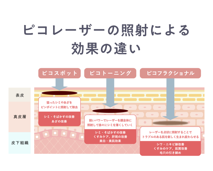 ピコレーザーの照射による効果の違い